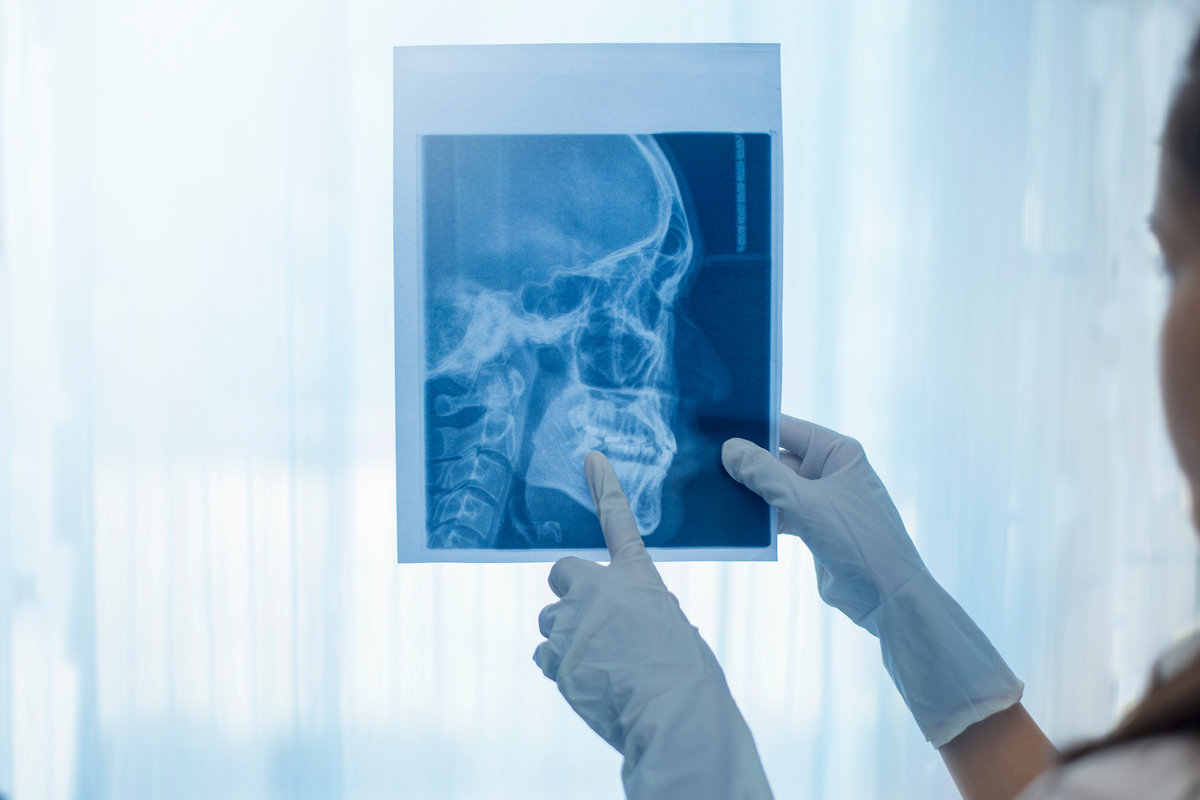 Female dentist holding a dental X-Ray