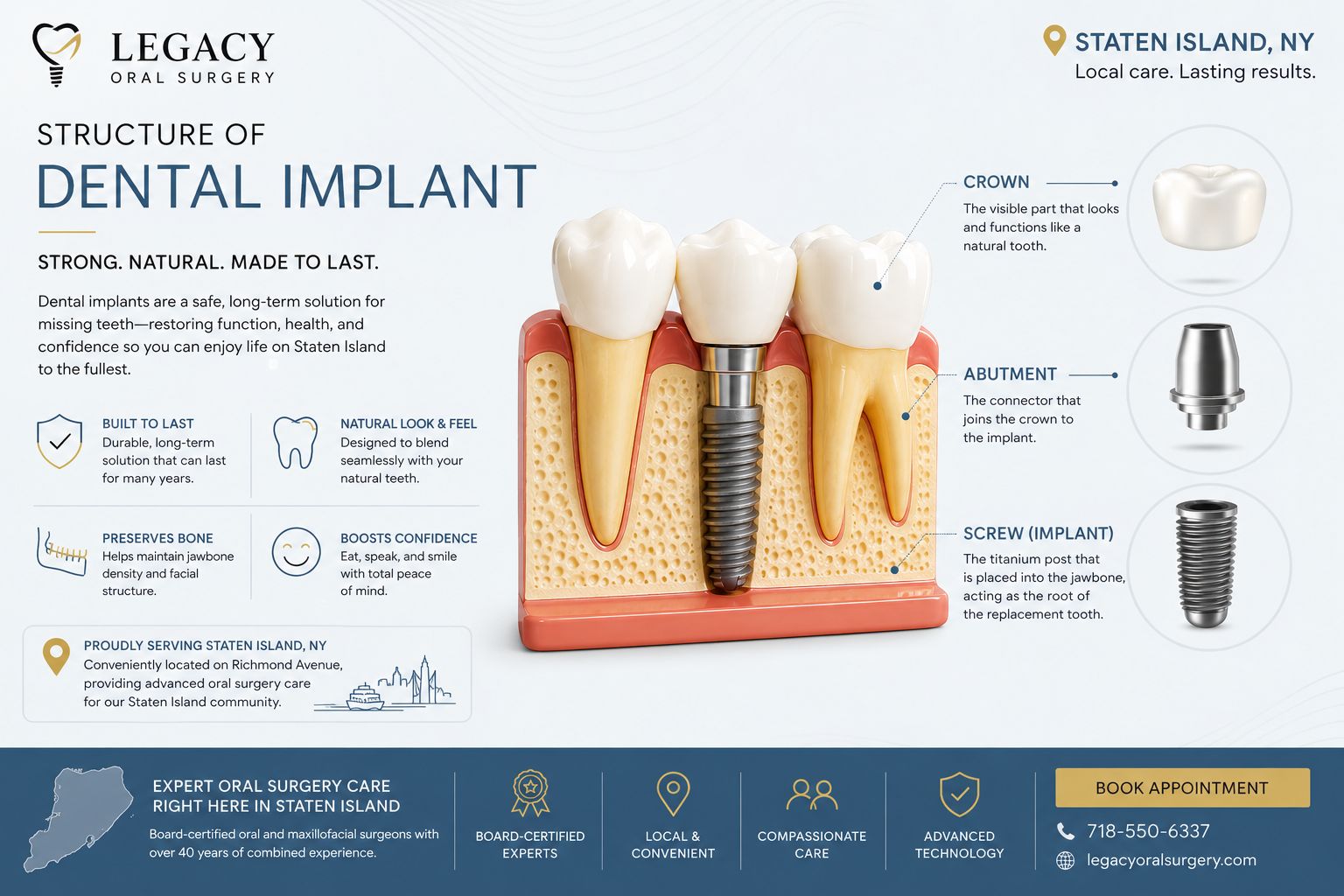 Dental implant model on display at Legacy Oral Surgery Staten Island office