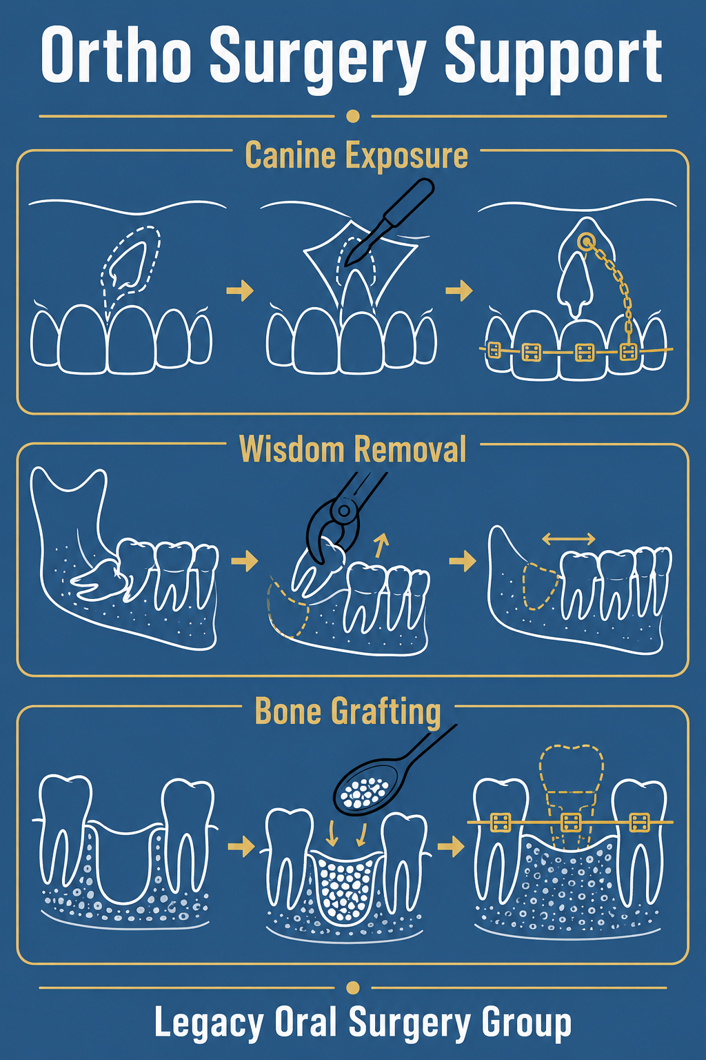 Infographic on procedures performed alongside braces or Invisalign